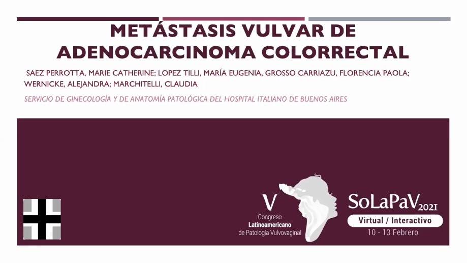Caso Clínico – Metástasis Vulvar de Adenocarcinoma Colorrectal